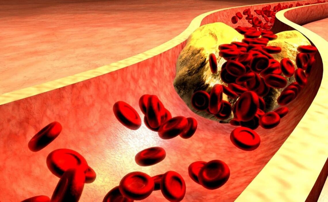 colesterol fruta dieta alimentación salud sangre circulación