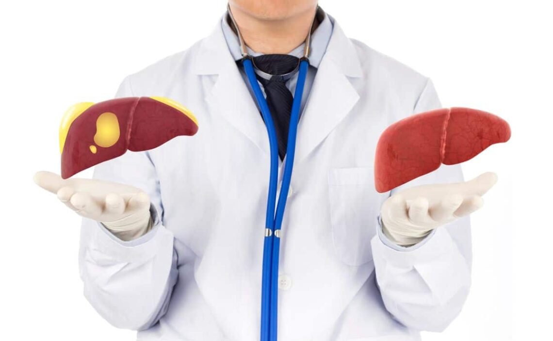 hígado graso circulación sanguínea órgano alimento ejercicios fruta digestivo