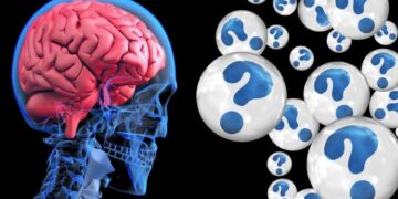 como actuar contra un ictus