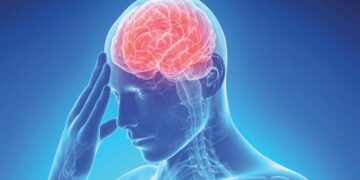 Daño cerebral accidente cerebrovascular
