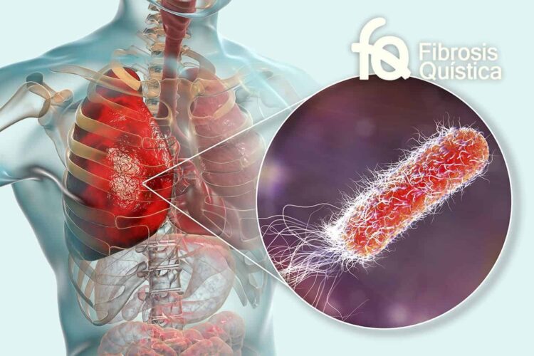 Fibrosis Quística