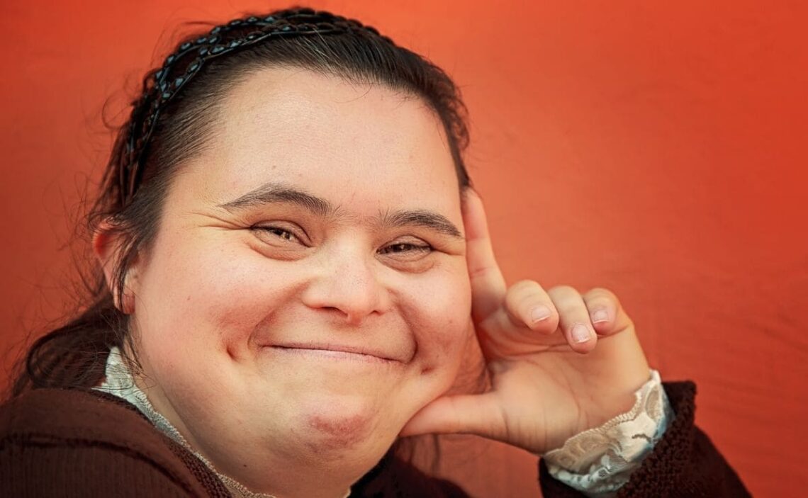 discapacidad intelectual sindrome de down empleo