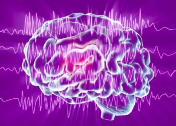 epilepsia cerebro