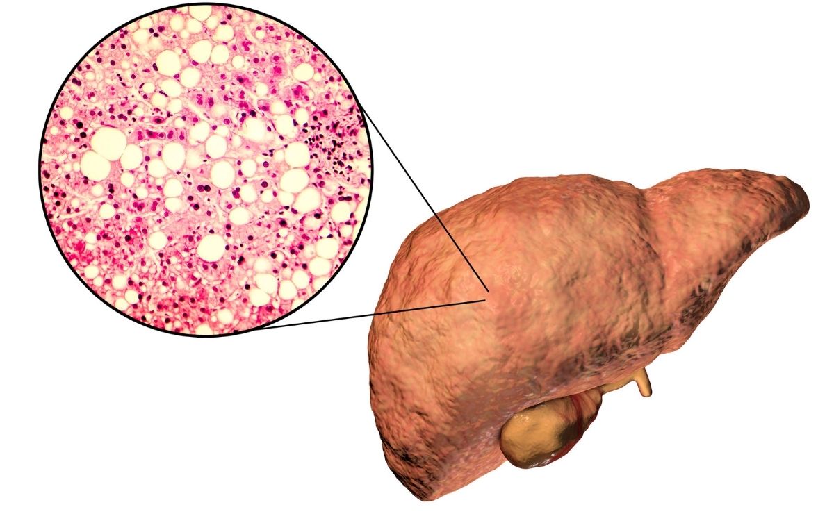 hígado graso órgano alimento verdura rábano hortaliza remedio casero médico