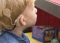 implante coclear niño discapacidad auditiva