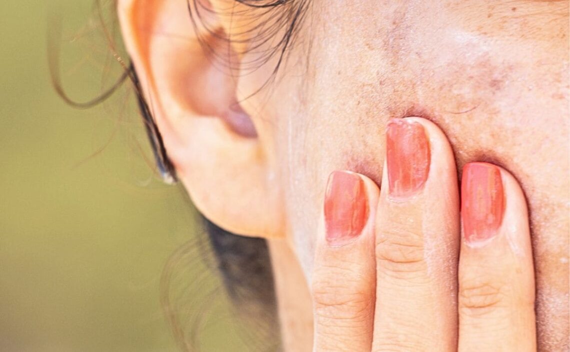 El sérum para las manchas con el ingrediente estrella para la piel