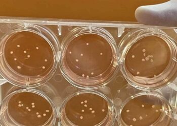 mini cerebros enfermedad del parkinson