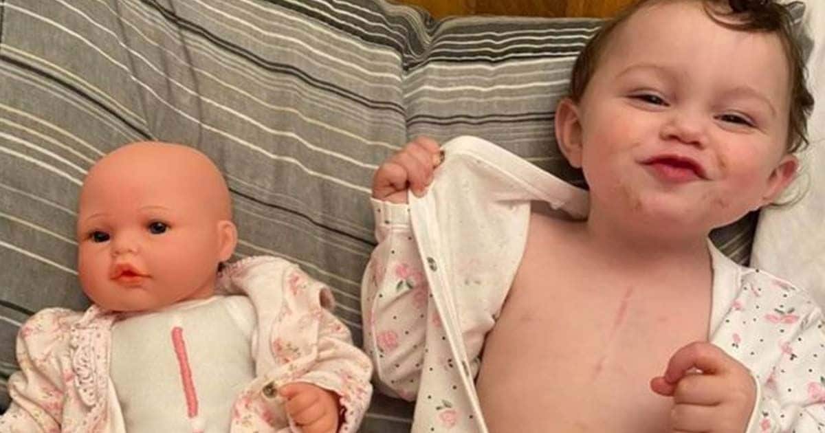 Un niño y su muñeco con cirugía cardíaca