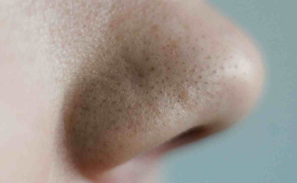 5 consejos para eliminar los puntos negros y la grasa de la nariz