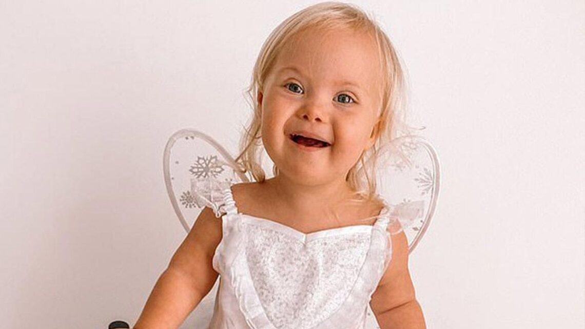 Willow Welbourn, bebé con síndrome de Down