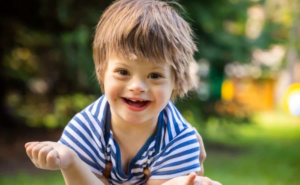 Niño con síndrome de Down, una discapacidad