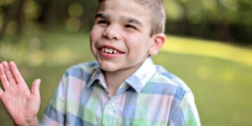 Niño con una enfermedad rara