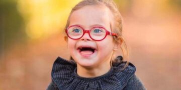 niño síndrome de down 2