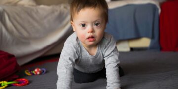 La fisioterapia es clave en la infancia de las personas con síndrome de Down