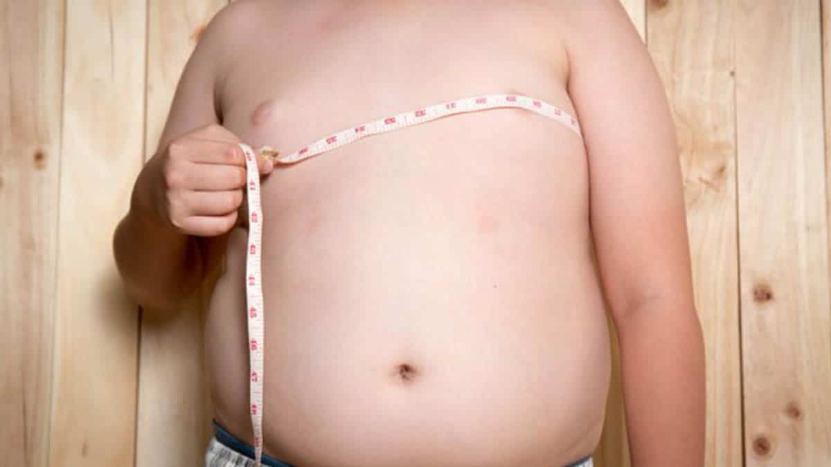 Obesidad infantil