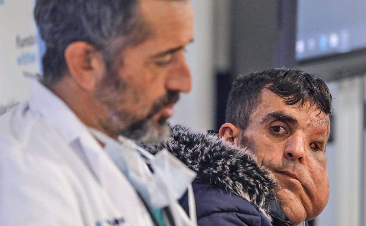 Ali, el joven al que Pedro Cavadas le ha extirpado una tumoración gigante en la cara: "Soy otra persona, ahora tengo vida"