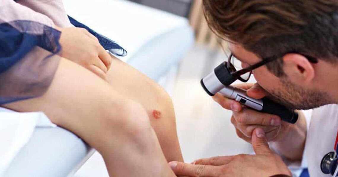 Osteosarcoma en niños