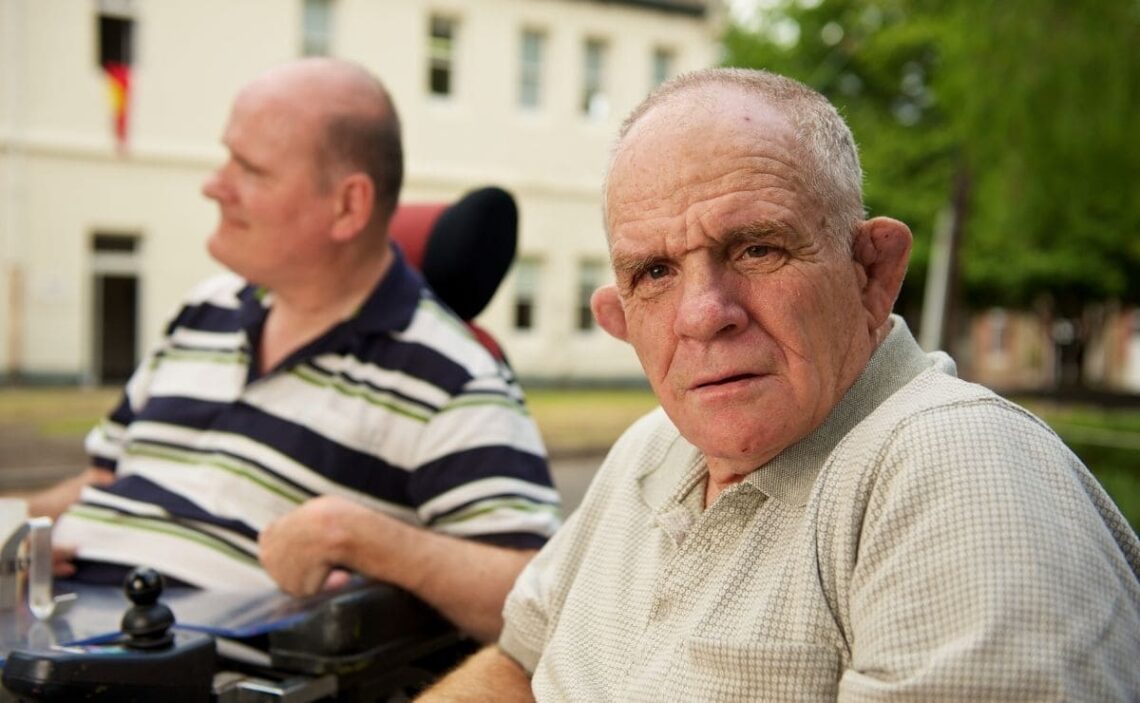 Las patologías crónicas, el principal factor de complejidad de las personas con discapacidad intelectual