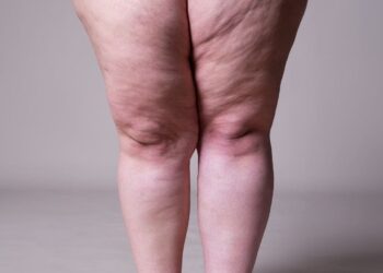 perder peso grasa piernas