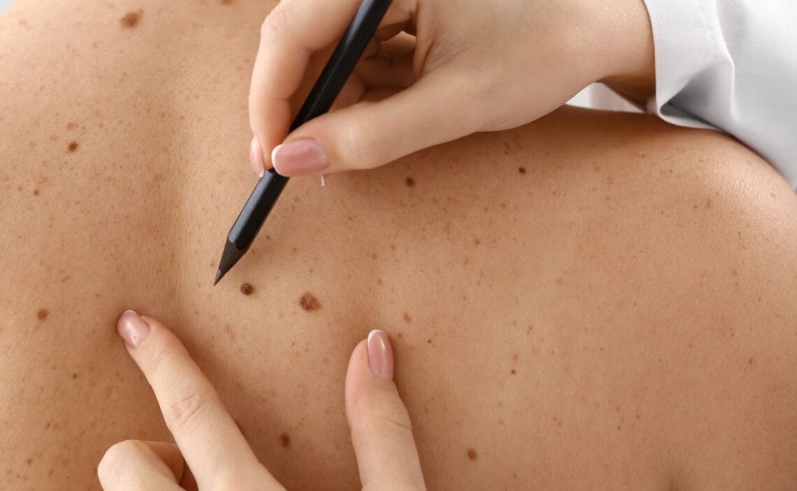 La investigación insta a las marcas a utilizar antioxidantes para aumentar beneficios de la piel