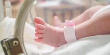 Pierna de un bebé reflujo gastroesofágico encefalopatía hipóxico-isquémica