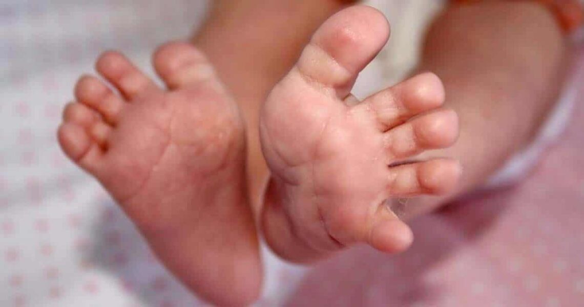 Bebé con fenilcetonuria