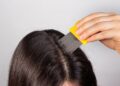 Uso del bicarbonato como remedio contra los piojos