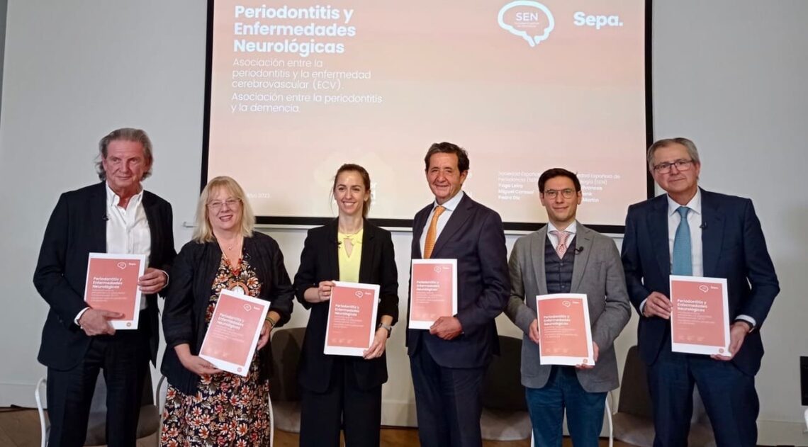 Las personas con periodontitis pueden tener casi el doble de riesgo de padecer Alzheimer y el triple de sufrir un ictus isquémico