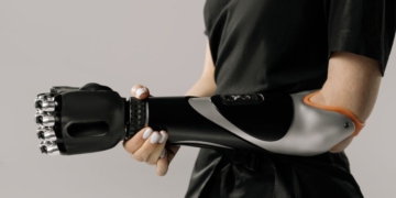 Expertos aseguran que las prótesis 3D van a ser el nuevo aliado de la parálisis cerebral