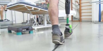 La prótesis de pierna que estimula los nervios mejora el movimiento y la funcionalidad en amputados. - FRANCESCO M. PETRINI - ARCHIVO