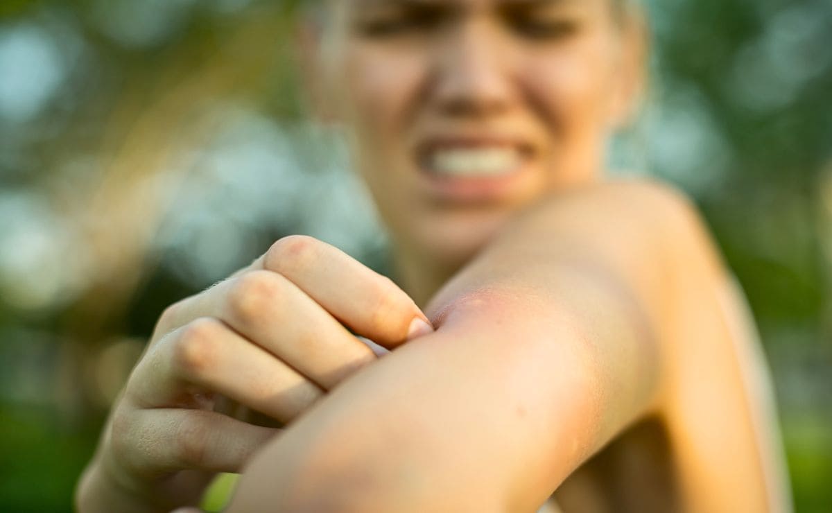 Remedios para eliminar los mosquitos del hogar