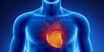 Controlar los factores de riesgo cardiovascular ayuda en la prevención del ictus