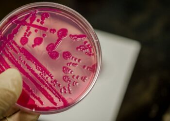 Consejos para prevenir la infección por salmonelosis