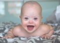 sindrome de down discapacidad bebe