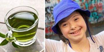 te verde niño con síndrome de down