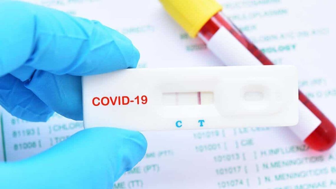 test Coronavirus Covid-19 APR