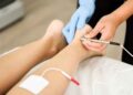 Electroacupuntura y Moxibustión, las nuevas técnicas para bajar los triglicéridos