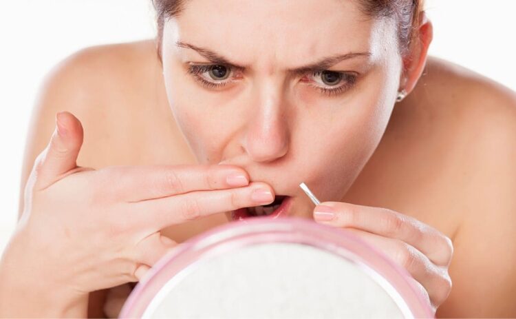 Así puedes eliminar el vello del bigote con bicarbonato y café./ Foto de Canva
