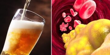 ¿Afecta tomar cerveza a los niveles de triglicéridos?