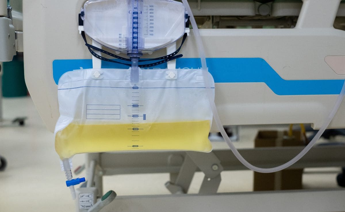 Escasez de bolsa de orina