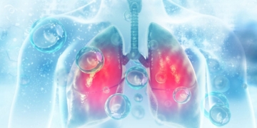 Preocupación por los 96 casos de silicosis en España encimeras pìedra