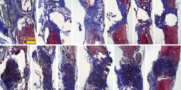 Investigadores del ICMM-CSIC logran reconectar una médula espinal seccionada con óxido de grafeno reducido