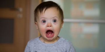 El Día Mundial del Síndrome de Down se conmemora cada 21 de marzo