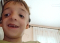 Pablo, niño con Síndrome Treacher Collins