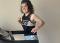 Carissa Resek, joven con síndrome de Apert