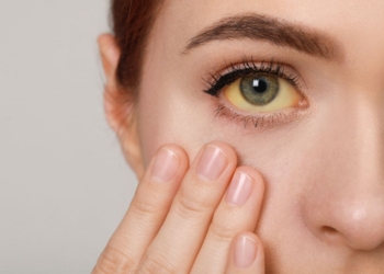 Incapacidad permanente por hepatitis autoinmune