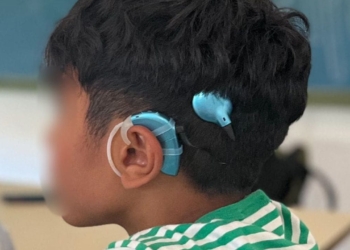 Roban el implante coclear a un niño en la Playa de La Antilla