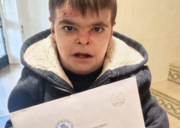 La Reina Letizia responde a la carta de Leo, niño con Piel de Mariposa: "Llegó a quien tenía que llegar"