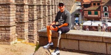 La vida de Nacho Heinze tras el accidente que le arrebató una pierna: "Una nueva forma de caminar en la vida"